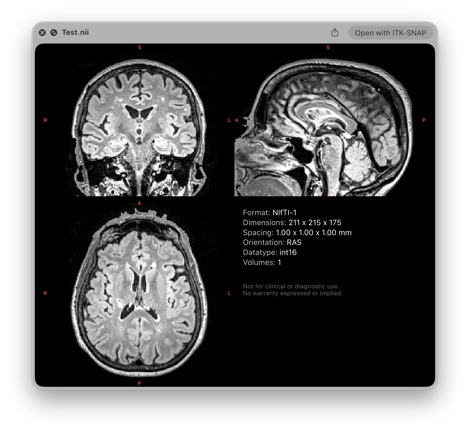 MIQ Quick Look preview showing a 2×2 orthogonal slice grid and metadata panel